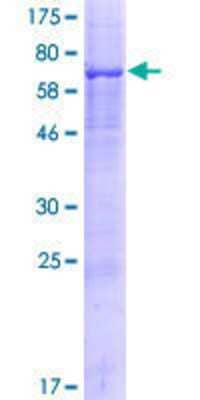 Other Recombinant Human PLD5 GST (N-Term) Protein