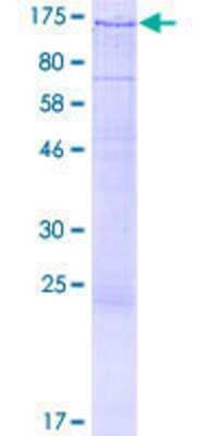 12.5% SDS-PAGE Stained with Coomassie Blue.