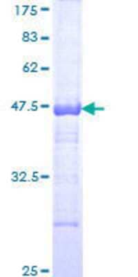 12.5% SDS-PAGE Stained with Coomassie Blue.