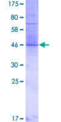 12.5% SDS-PAGE Stained with Coomassie Blue.