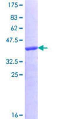 12.5% SDS-PAGE Stained with Coomassie Blue.