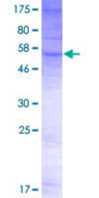 SDS-Page: Recombinant Human OSTalpha Protein [H00200931-P01] - 12.5% SDS-PAGE Stained with Coomassie Blue.