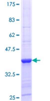 12.5% SDS-PAGE Stained with Coomassie Blue.