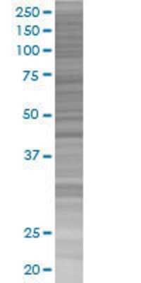 ZNF584 transfected lysate.