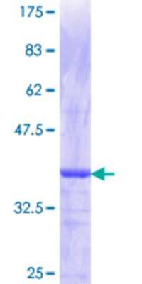 12.5% SDS-PAGE Stained with Coomassie Blue.