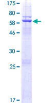 12.5% SDS-PAGE Stained with Coomassie Blue.