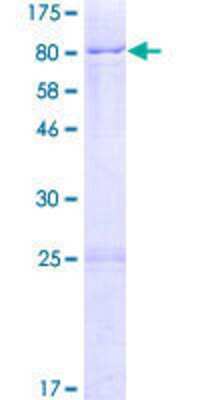 12.5% SDS-PAGE Stained with Coomassie Blue.