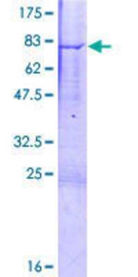 12.5% SDS-PAGE Stained with Coomassie Blue.