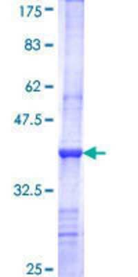 12.5% SDS-PAGE Stained with Coomassie Blue.