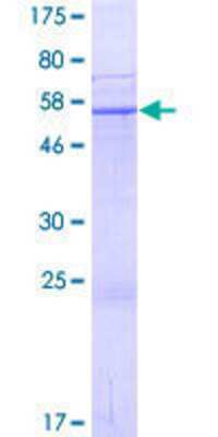 12.5% SDS-PAGE Stained with Coomassie Blue.