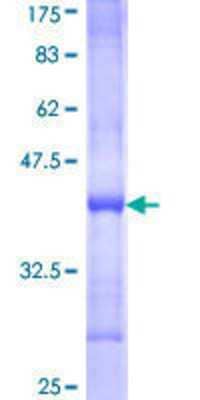 SDS-Page: Recombinant Human NRK Protein [H00203447-Q01] - 12.5% SDS-PAGE Stained with Coomassie Blue.