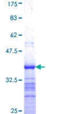 Other Recombinant Human LASS3 GST (N-Term) Protein