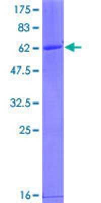 12.5% SDS-PAGE Stained with Coomassie Blue.