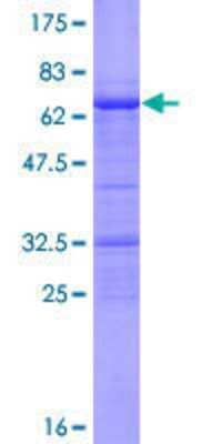 12.5% SDS-PAGE Stained with Coomassie Blue.