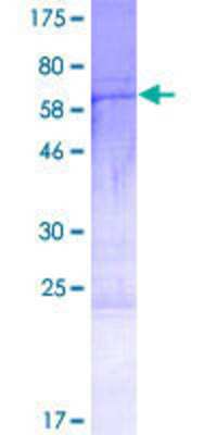 12.5% SDS-PAGE Stained with Coomassie Blue.