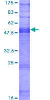 12.5% SDS-PAGE Stained with Coomassie Blue.