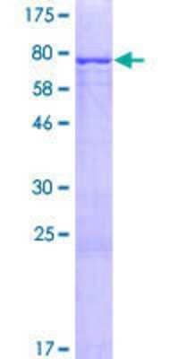 12.5% SDS-PAGE Stained with Coomassie Blue.