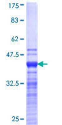 12.5% SDS-PAGE Stained with Coomassie Blue.