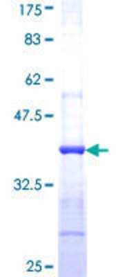 12.5% SDS-PAGE Stained with Coomassie Blue.