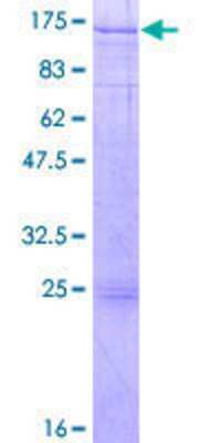 12.5% SDS-PAGE Stained with Coomassie Blue.