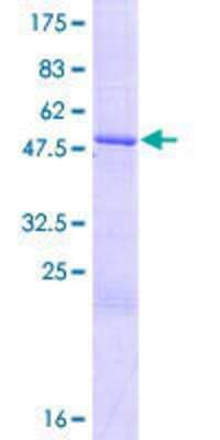 SDS-Page: Recombinant Human ZNF192P2 Protein [H00222701-P01] - 12.5% SDS-PAGE Stained with Coomassie Blue.