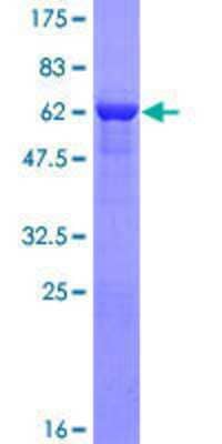 12.5% SDS-PAGE Stained with Coomassie Blue.