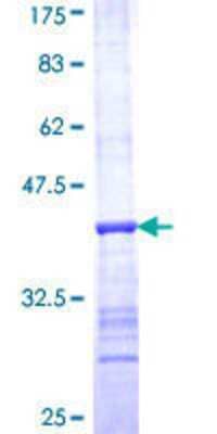 12.5% SDS-PAGE Stained with Coomassie Blue.