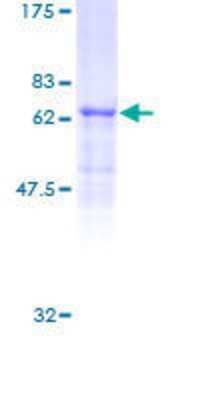 12.5% SDS-PAGE Stained with Coomassie Blue.