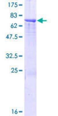 12.5% SDS-PAGE Stained with Coomassie Blue.