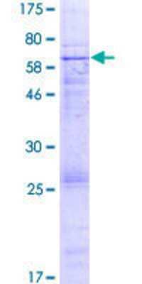 SDS-Page: Recombinant Human EPHX4 Protein [H00253152-P01] - 12.5% SDS-PAGE Stained with Coomassie Blue.