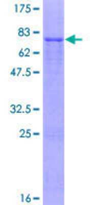 SDS-PAGE Recombinant Human IPMK GST (N-Term) Protein