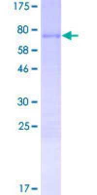 12.5% SDS-PAGE Stained with Coomassie Blue.