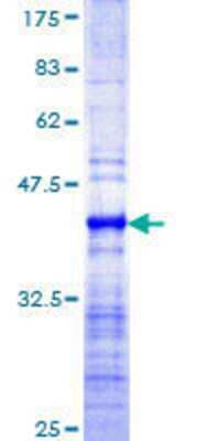 12.5% SDS-PAGE Stained with Coomassie Blue.