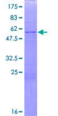 12.5% SDS-PAGE Stained with Coomassie Blue.