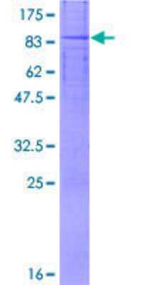 12.5% SDS-PAGE Stained with Coomassie Blue.