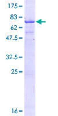 Other Recombinant Human CT47A11 GST (N-Term) Protein