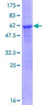 12.5% SDS-PAGE Stained with Coomassie Blue.