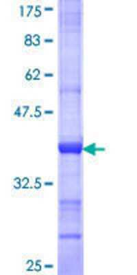 12.5% SDS-PAGE Stained with Coomassie Blue.