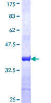12.5% SDS-PAGE Stained with Coomassie Blue.
