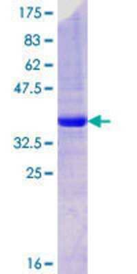 12.5% SDS-PAGE Stained with Coomassie Blue.