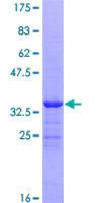 12.5% SDS-PAGE Stained with Coomassie Blue.