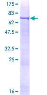 12.5% SDS-PAGE Stained with Coomassie Blue.