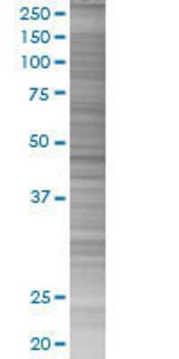 Rgr transfected lysate.