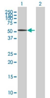 Lane 1: Rgr transfected lysate (44.9 KDa) Lane 2: Non-transfected lysate.