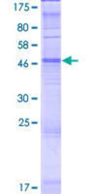 12.5% SDS-PAGE Stained with Coomassie Blue.