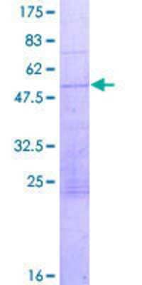 12.5% SDS-PAGE Stained with Coomassie Blue.