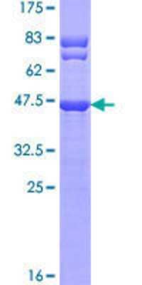 12.5% SDS-PAGE Stained with Coomassie Blue.