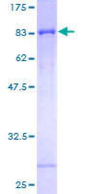 12.5% SDS-PAGE Stained with Coomassie Blue.