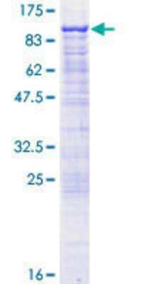 12.5% SDS-PAGE Stained with Coomassie Blue.