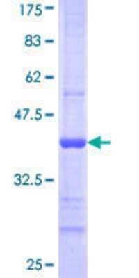 12.5% SDS-PAGE Stained with Coomassie Blue.